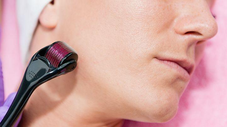 Derma Roller Anti Ageing And Facial Scrubs Polishes Scar Removal Hair Regrowth - warehousetech13