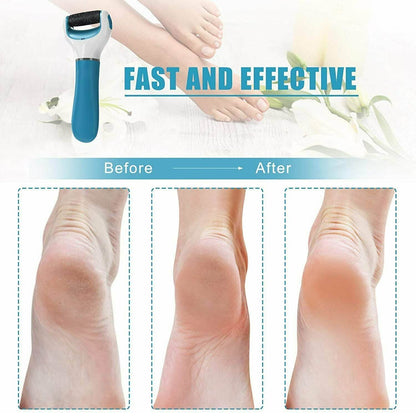 Electronic Dry Foot File Callous Remover For Feet Electric Foot With Roller Hard And Dead Skin- Regular Coarse Baby Smooth Feet In Minutes. - warehousetech13
