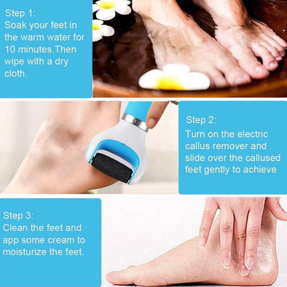 Electronic Dry Foot File Callous Remover For Feet Electric Foot With Roller Hard And Dead Skin- Regular Coarse Baby Smooth Feet In Minutes. - warehousetech13